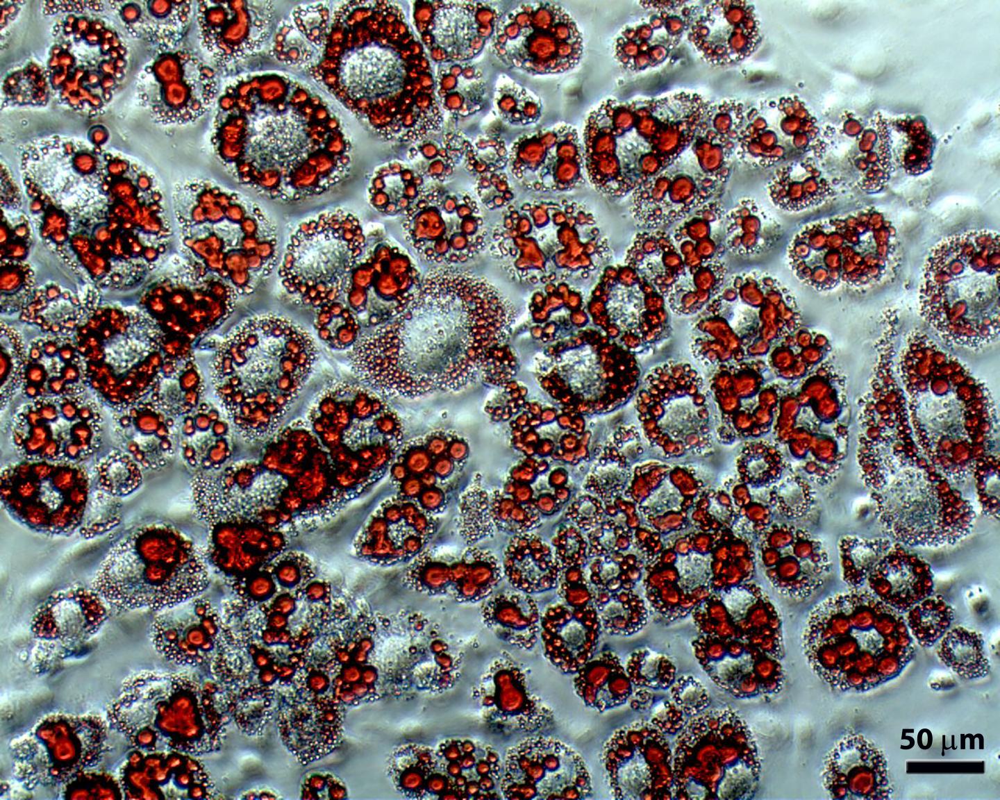 Microscopy Image Depicting Fat Cells (or Adipocytes) After Differentiation