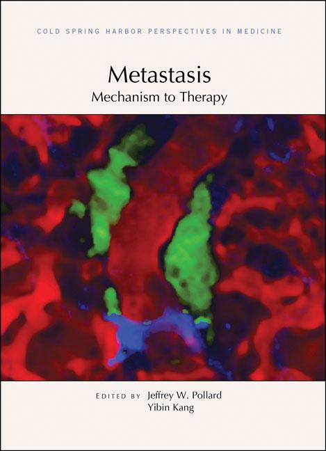 Metastasis; Mechanism to Therapy