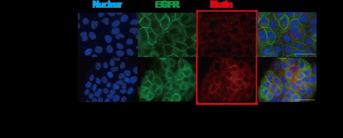 Immunostaining picture of FabID binding to EGFR on cultured cells, labelled on the plasma membrane.