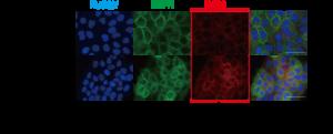 Immunostaining picture of FabID binding to EGFR on cultured cells, labelled on the plasma membrane.