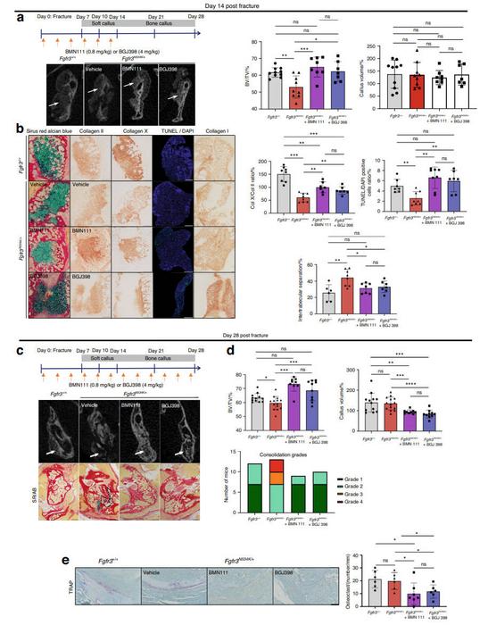 Defective bone repair with pseudarthrosis in Fgfr3N534K/+ mice is rescued by BMN111 and BGJ398.