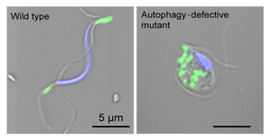 Wild-type and defective spermatozoids in autophagy.