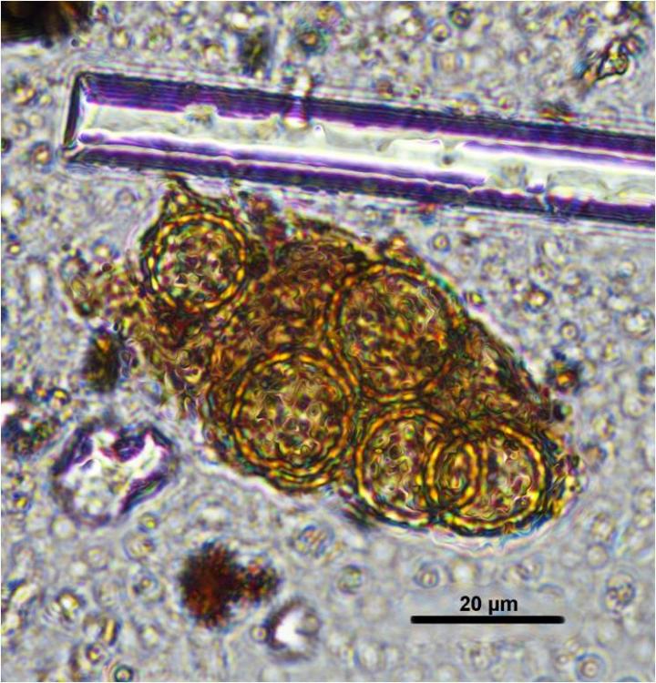 Pollen of Chenopodiaceae