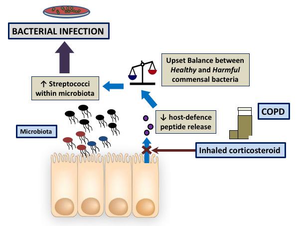 Inhaled Corticosteroid Drugs Worsen Bacterial Lung Infections in COPD (1 of 3)