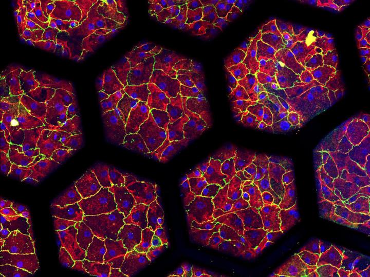 Immunostaining of patients cell cultures on a secondgeneration lung-on-chip.