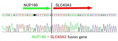 The Novel Fusion Gene NUP160-SLC43A3