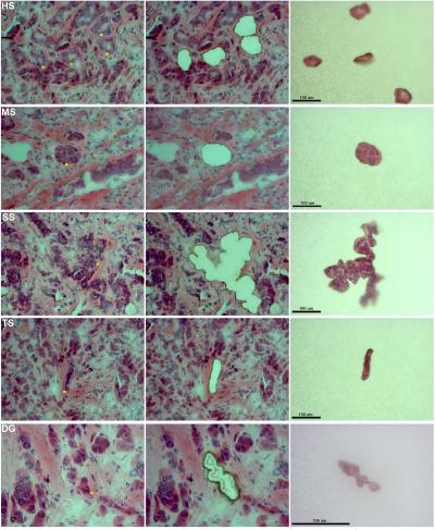 Laser Microdissection