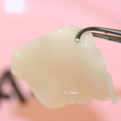 Scientists grow cartilage to reconstruct nose | EurekAlert!