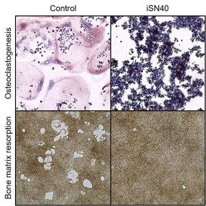 Suppression of osteoclastogenesis and bone matrix resorption by iSN40