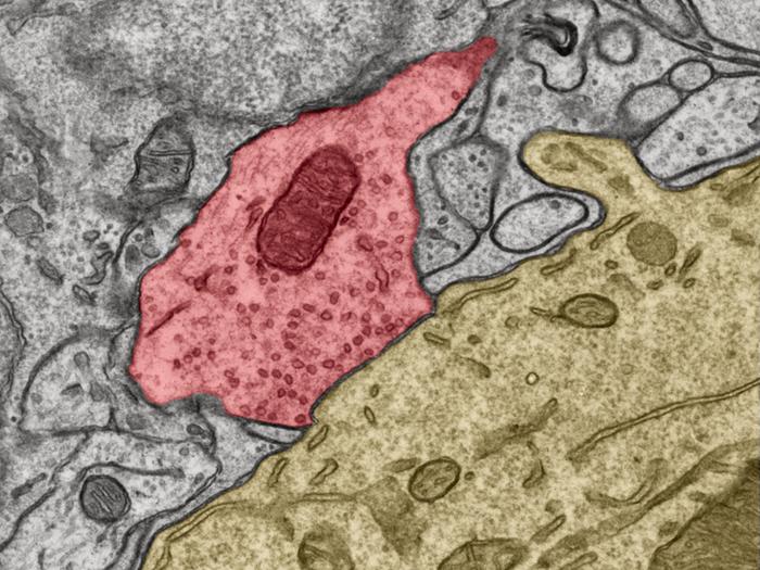 Electron microscope image of synapse in the cerebellum