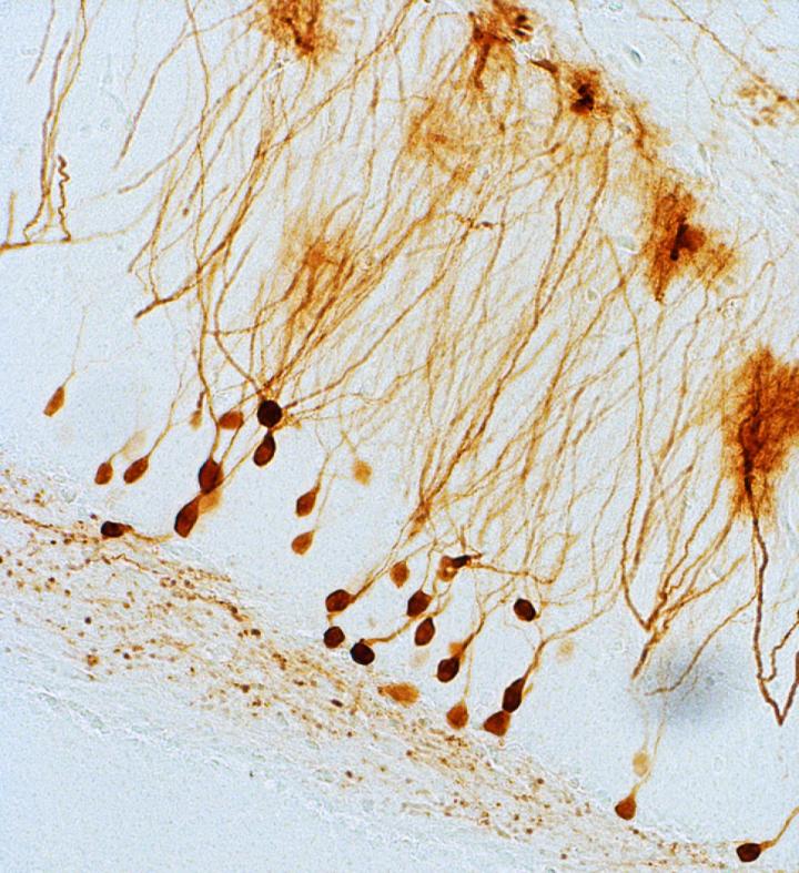 Nerve Cells inside the Hippocampus (Animal Model)