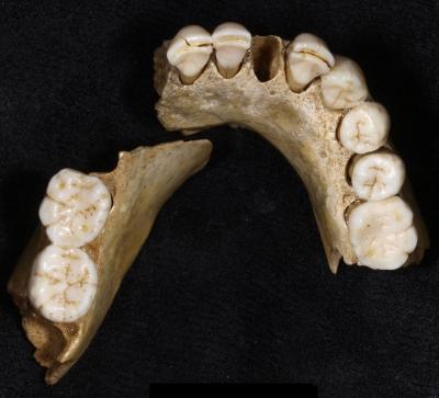 Neandertal Teeth