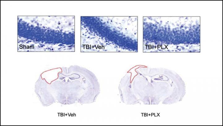 Resetting Immune Cells Improves Traumatic Brain Injury Recovery in Mice