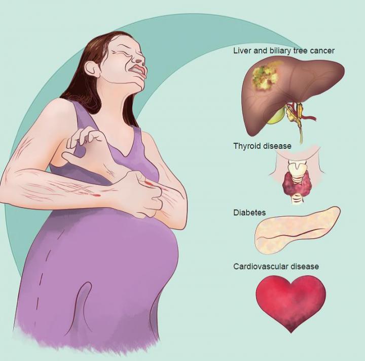 Intrahepatic Cholestasis of Pregnancy Linked with Liver Cancer