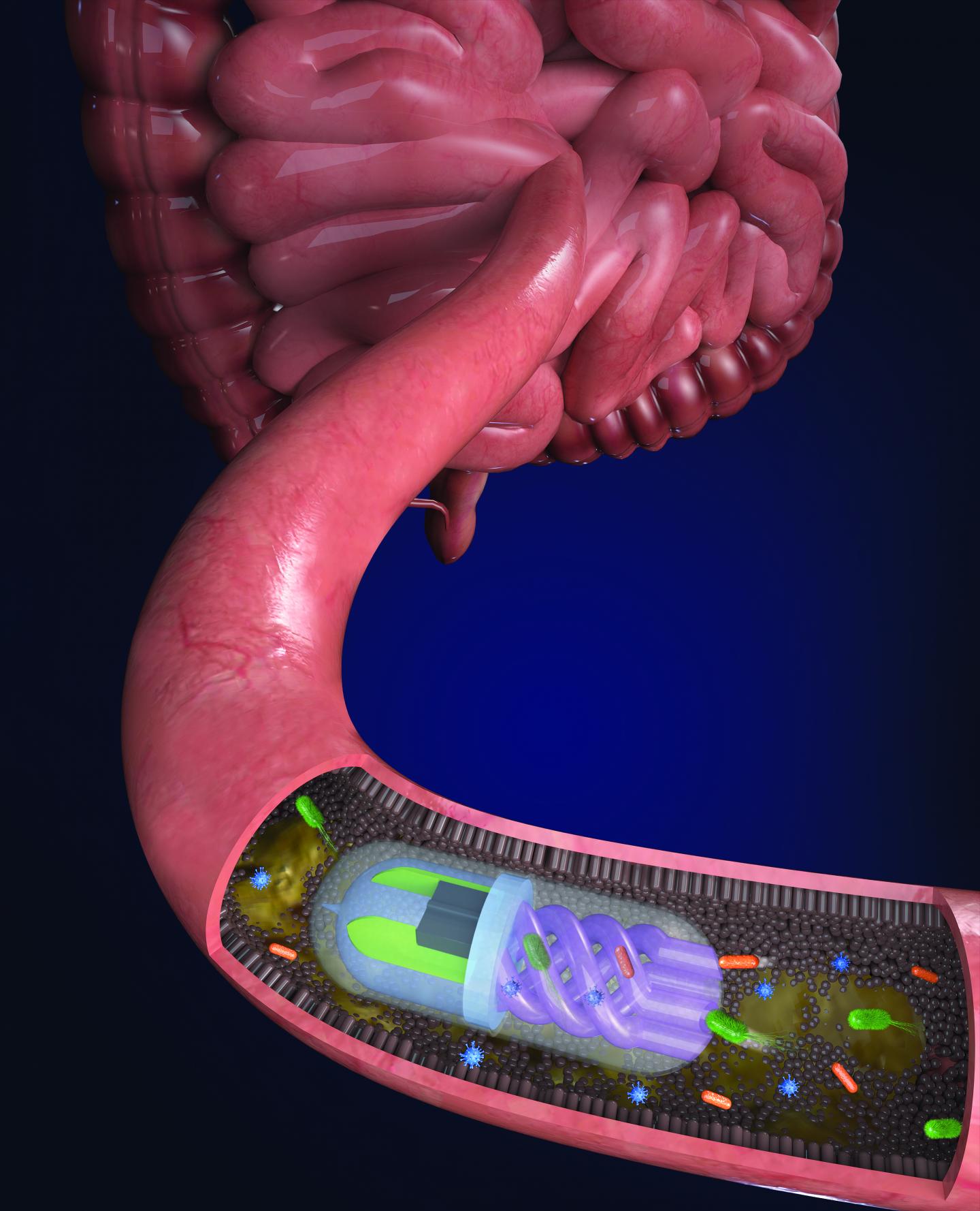 Microbiome Sampling Pill in the Small Intestine