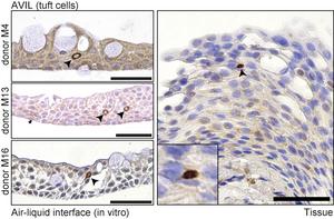 Tuft cells