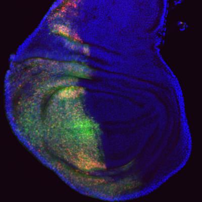 Polycomb Repressive Complex 2