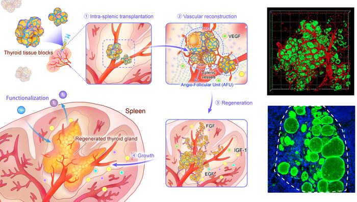Schematic description of intra-splenic thyroid regeneration (left) and staining images of reconstructed thyroid tissues within the spleen (right)