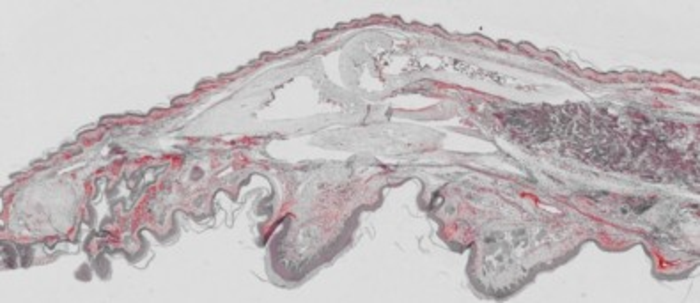 Immunohistochemistry