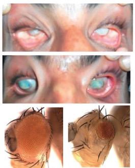 human eye mutations