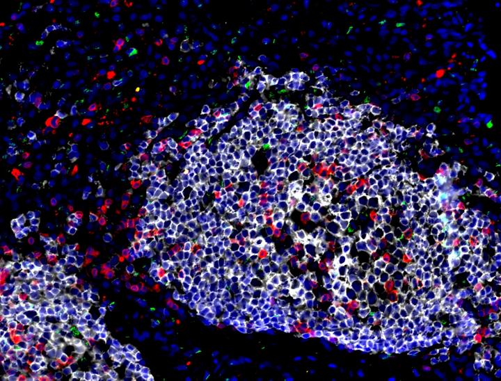 ILC3 in Latent Tuberculosis