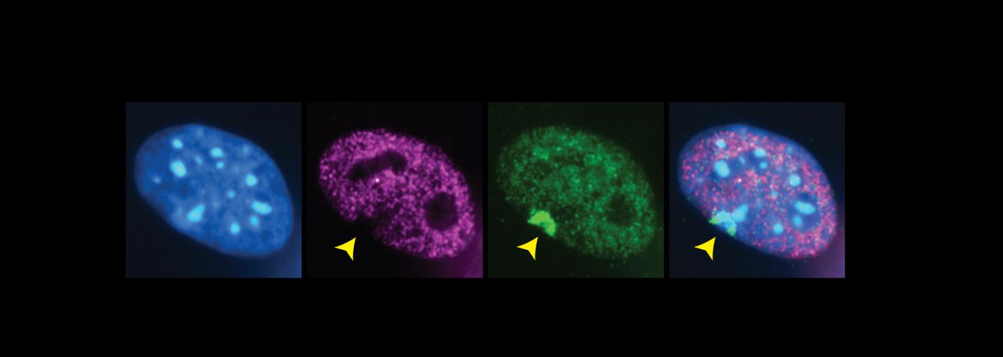Inactive X chromosomes