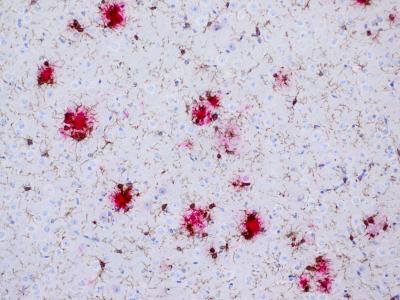 Microglia and Alzheimer's Plaques