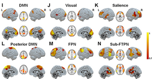 Time-resolved functional networks in disorders of consciousness