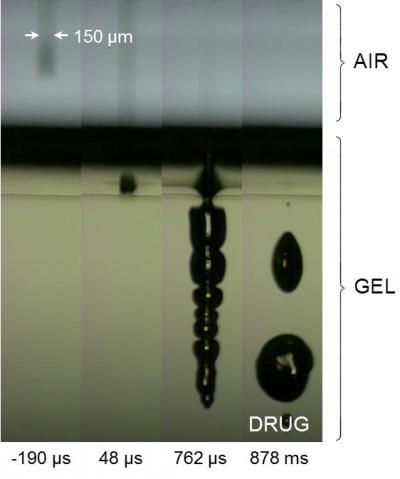 Gel Simulation of Laser 'Needle'