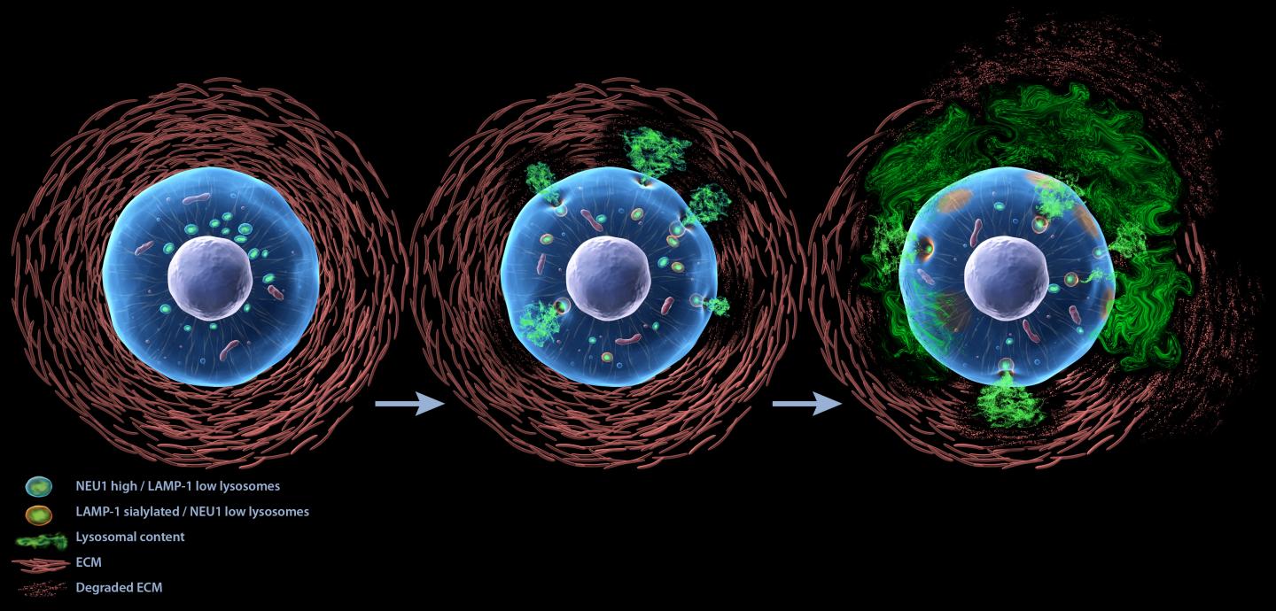 Regulated Lysosomal Exocytosis Mediates Cancer Progression (1 of 2)