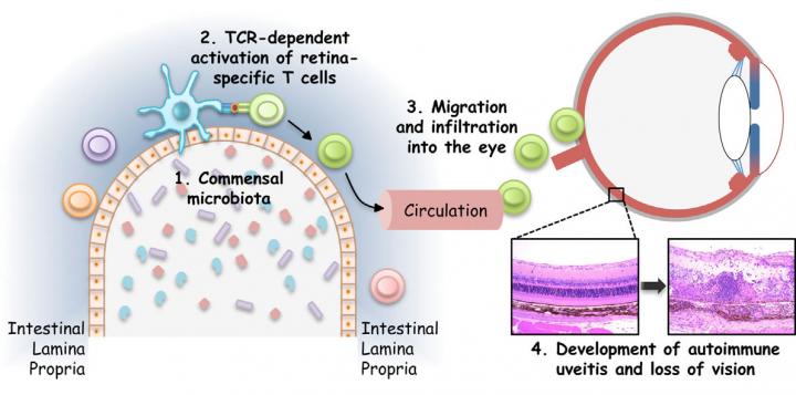 Gut Microbes and Autoimmune Eye Disease