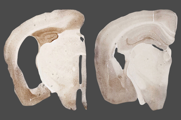 New strategy reduces brain damage in Alzheimer’s and related disorders, in mice