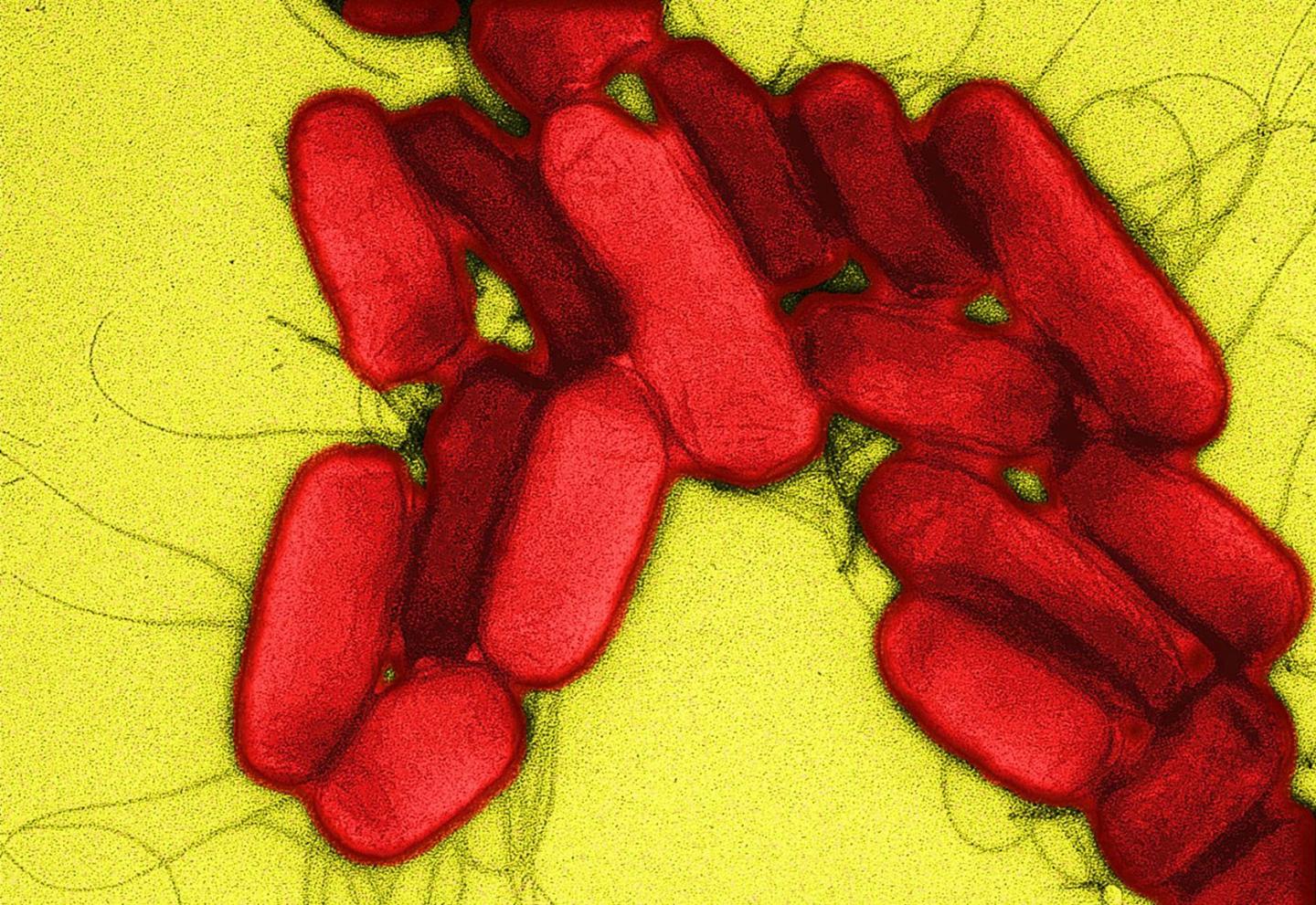 <i>Salmonella</i> under the Microscope