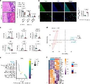 B16F10 Cell-Induced Osteocyte Ferroptosis in Bone Metastasis.