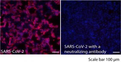 Most people are naturally armed against SARS-CoV-2