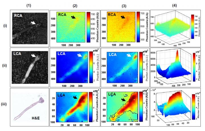 F-18-FDG Radioluminescence Imaging of Murine Arterial Sample