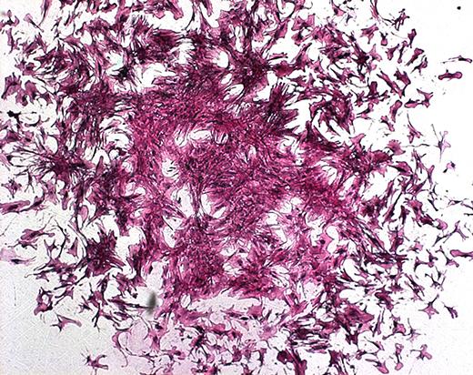Human Bone Stem Cells