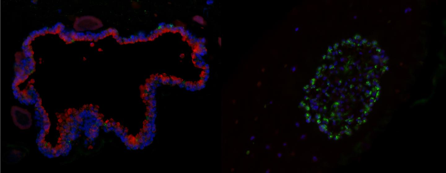 Driving Lung Cell Formation