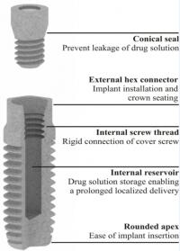 Conceptual Design of the Dental Implant