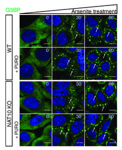 Stress granule formation