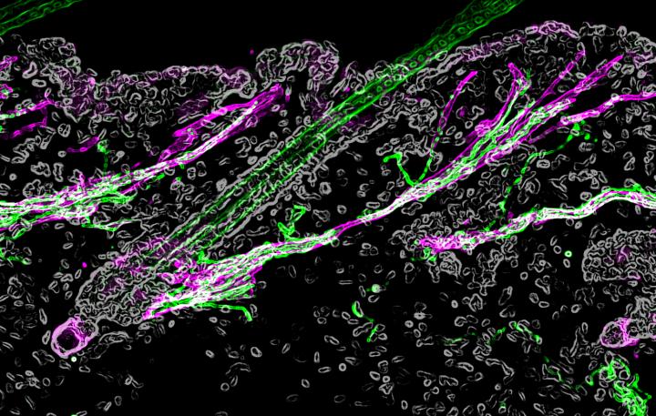 Cell Types that Cause Goosebumps also Control Hair Growth