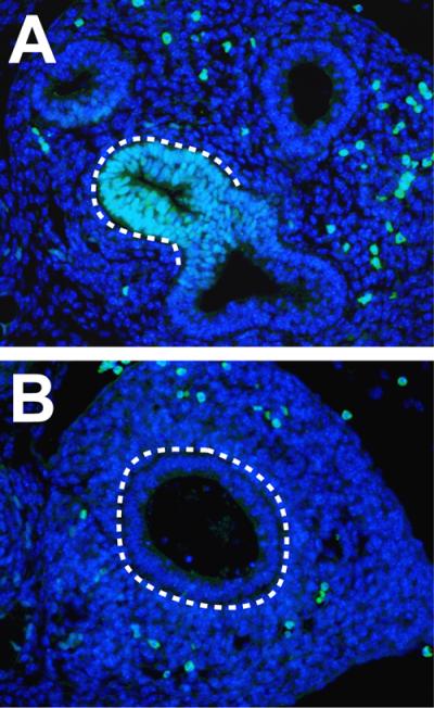 Tweaking Gene Expression to Repair Lungs