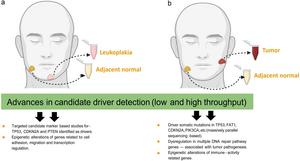 Progression of Oral Leukoplakia to Cancer