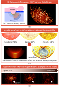 Virtual imaging trials to investigate the impact of skin color on 3D optoacoustic tomography of the breast