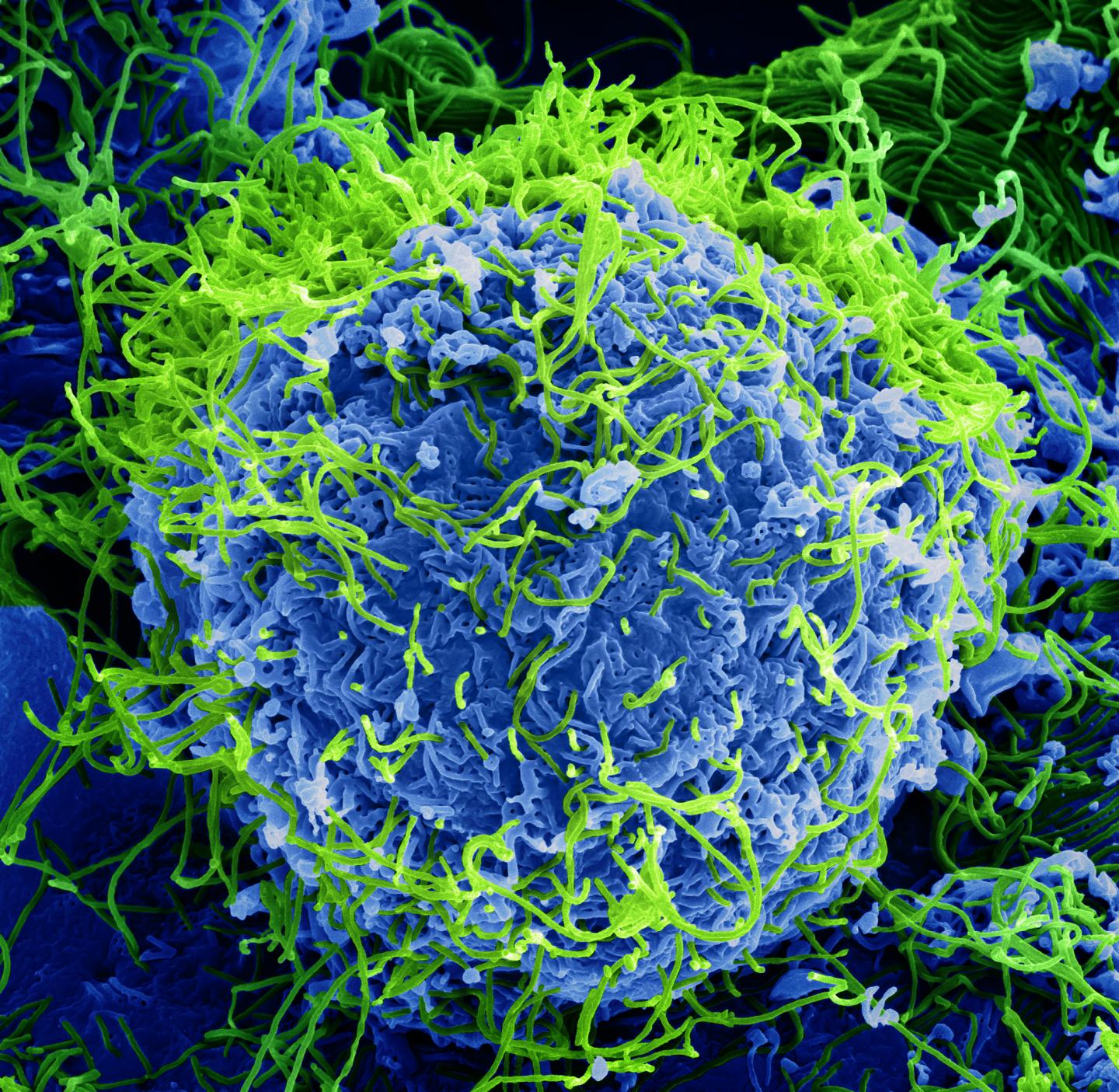 Colorized Scanning Electron Micrograph of Ebola Virus Particles