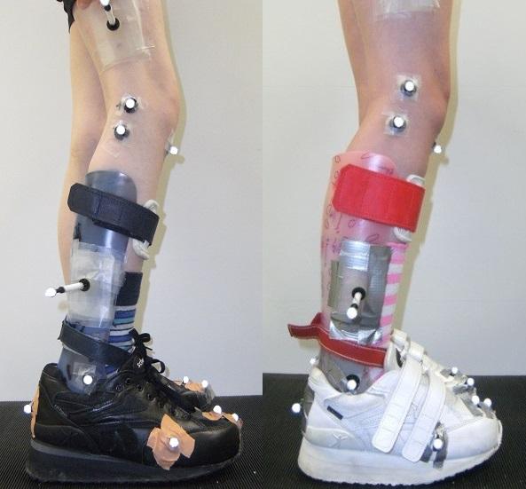 Ankle Foot Orthosis