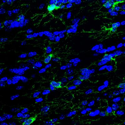 Optogenetics Links Neuronal Activity to Adaptive Changes in Myelin (6 of 6)