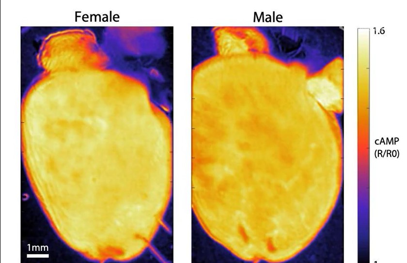Female and Male Mouse Hearts Responding to the Stress Hormone Noradrenaline