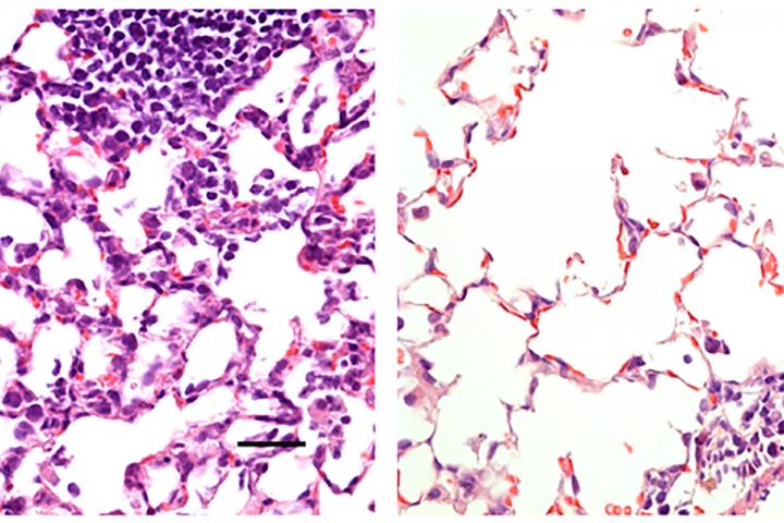 Nasal vaccine against COVID-19 prevents infection in mice