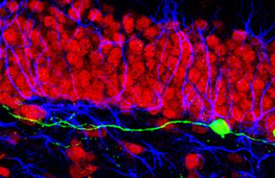 Newborn Neurons in the Adult Brain Can Settle in the Wrong Neighborhood